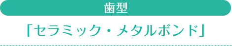 歯型「セラミック・メタルボンド」