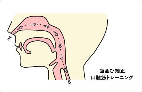 歯並び矯正　口腔筋トレーニング