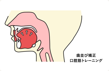 歯並び矯正　口腔筋トレーニング