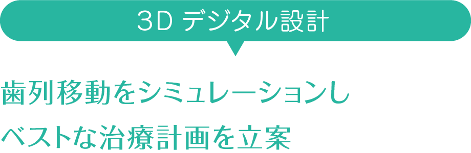 ３Dデジタル設計 歯列移動をシミュレーションしベストな治療計画を立案